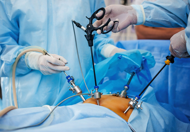 Laparoscopic Surgery